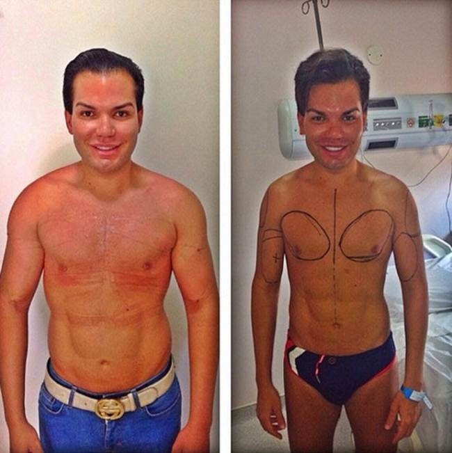 Brazilian-Rodrigo-Alves-58-plastic-surgeries-010